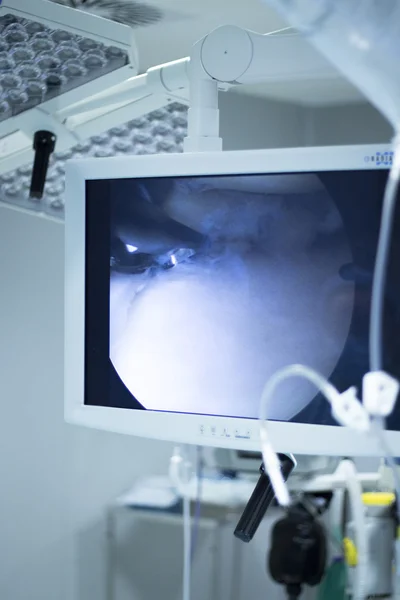 Cirugía hospitalaria artroscopia pantalla de operación —  Fotos de Stock