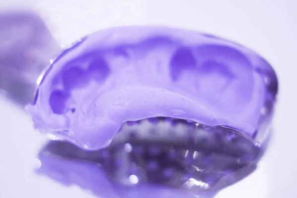 Protetyka stomatologiczna żel formy zęba — Zdjęcie stockowe
