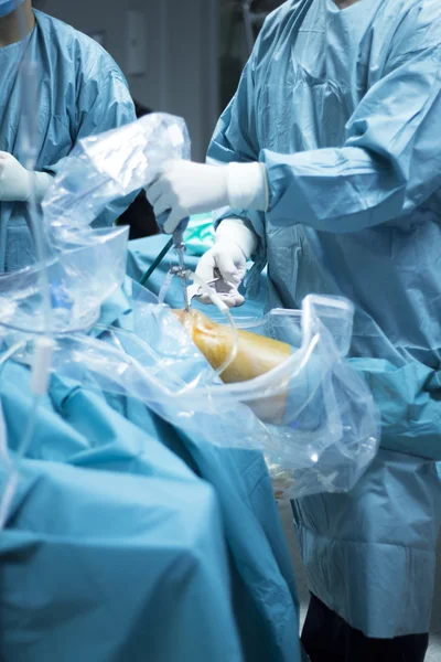 Knee arthroscopy operasi bedah ortopedi — Stok Foto