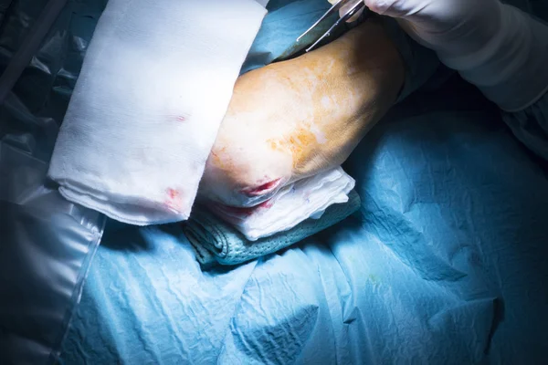 Kórházi könyök ortopédia sebészet működését — Stock Fotó