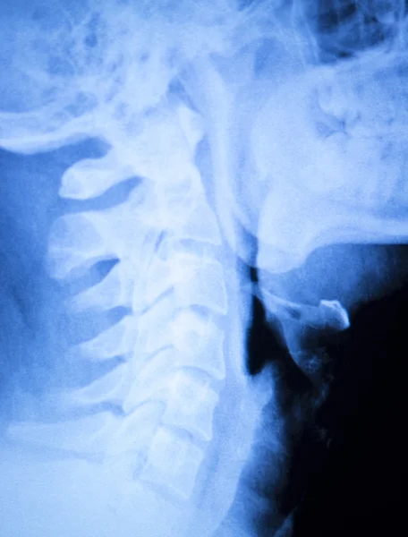 Kneck és a gerinc sérülés röntgen vizsgálat — Stock Fotó