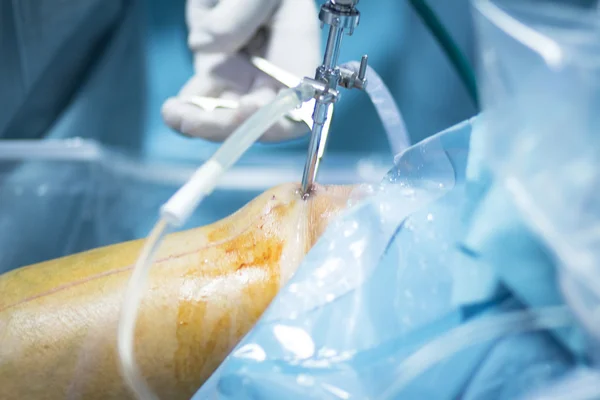 Ortopedi knä operation sjukhus drift — Stockfoto