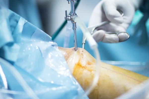 Orthopédie chirurgie du genou chirurgie hospitalière — Photo