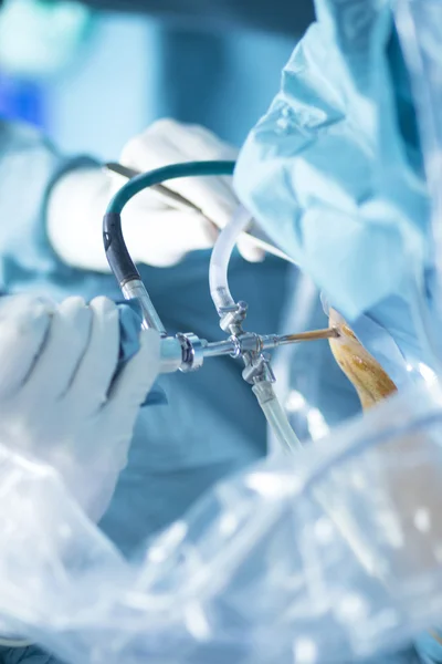 Operasi bedah Traumatologi Ortopedi — Stok Foto