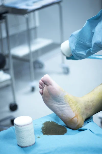 Arthroscopie du genou chirurgie orthopédique — Photo