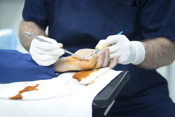 Νοσοκομείο λειτουργία ορθοπεδική χειρουργική επέμβαση χεριών — Φωτογραφία Αρχείου