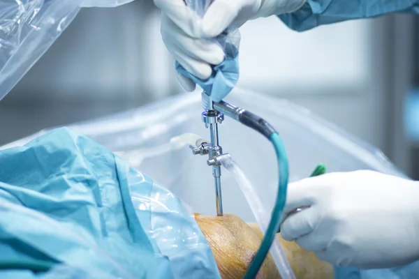 Ortopedii Traumatologii operacja chirurgiczna — Zdjęcie stockowe