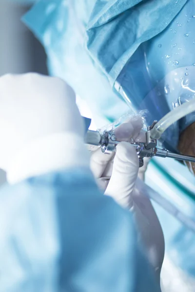 Ortopedia cirurgia do joelho operação hospitalar — Fotografia de Stock