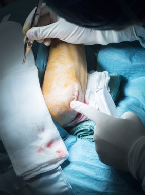 Hastane dirsek ortopedi Cerrahi operasyon