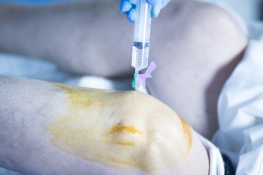 Diz cerrahisi anestezi enjeksiyonu