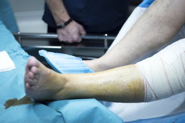 Diz artroskopisi ortopedik cerrahi operasyon