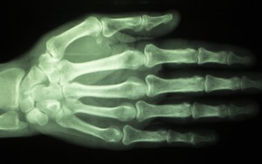 El parmak başparmak hastane xray inceden inceye gözden geçirmek