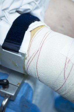 Diz artroskopisi ortopedik cerrahi operasyon