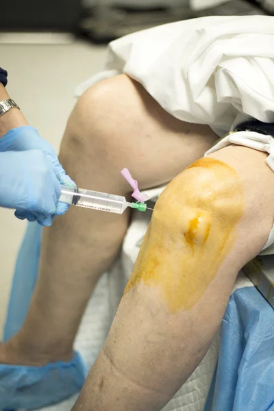 Knee arthroscopy orthopedic surgery operation — Stock Photo, Image