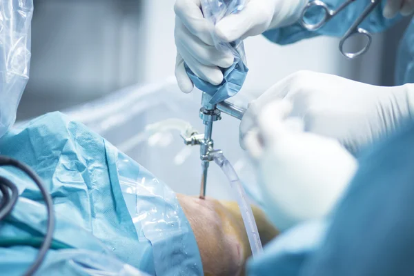 Cirugía ortopédica de rodilla operación hospitalaria —  Fotos de Stock