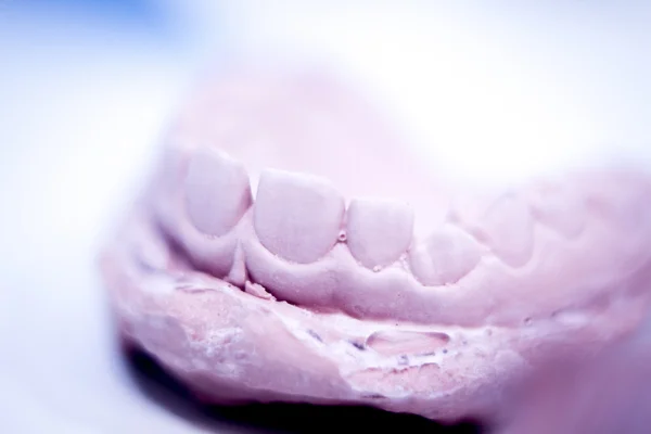 Prótesis dental molde dental de arcilla — Foto de Stock