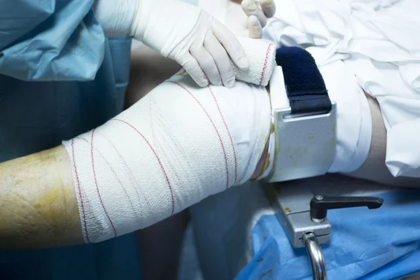 Knee arthroscopy orthopedic surgery operation — Stock Photo, Image