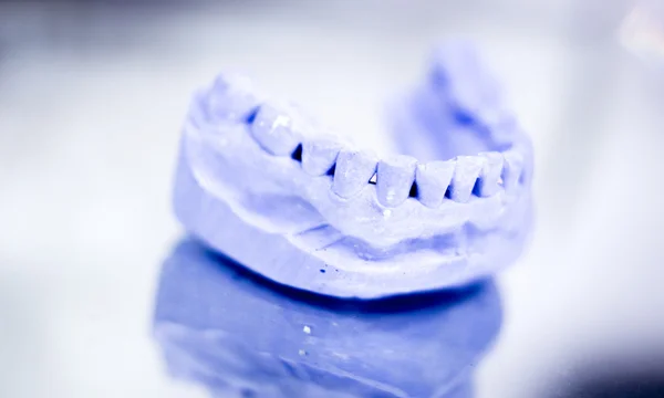 Dental prosthetics clay tooth mold — Stock Photo, Image