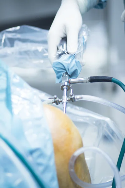 Ortopedi Travmatoloji Cerrahi operasyon