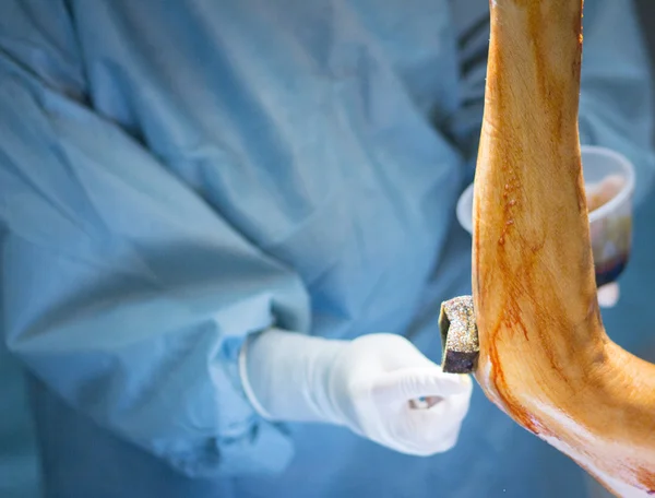 Lesión de codo cirugía hospitalaria sala de emergencias — Foto de Stock