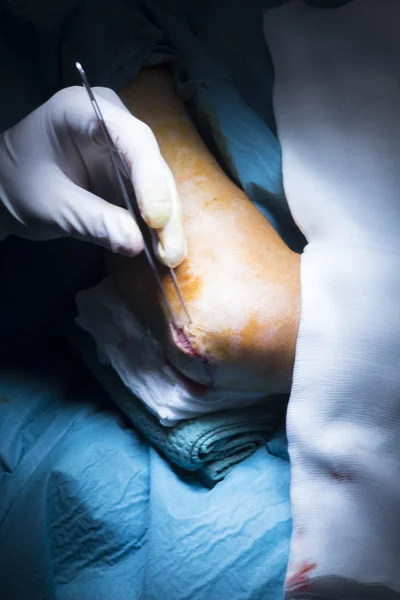 Операція з хірургічного втручання лікарняного ліктя — стокове фото