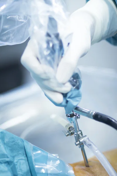 Ορθοπεδική χειρουργική επέμβαση γόνατος νοσοκομείο λειτουργία — Φωτογραφία Αρχείου