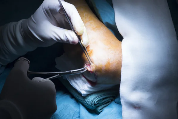 Operasi bedah ortopedi rumah sakit — Stok Foto