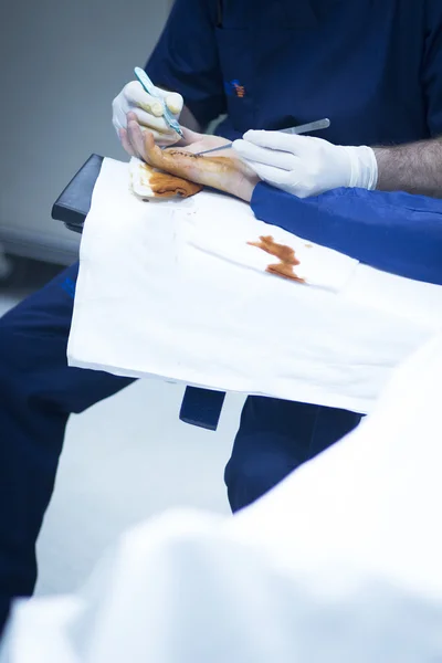 Krankenhaus Handchirurgie Orthopädie Operation — Stockfoto