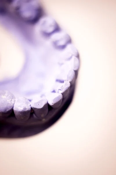 Dental prosthetics clay tooth mold — Stock Photo, Image
