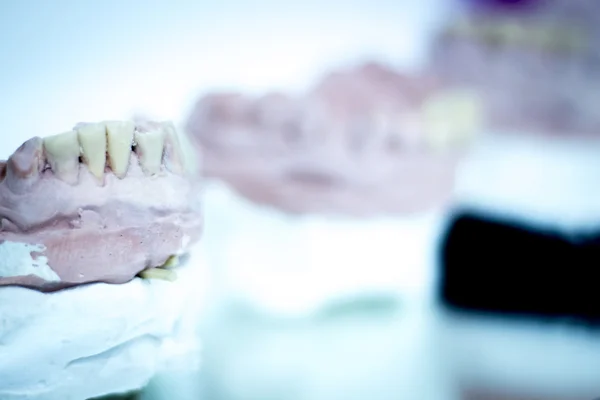 Зубной протез глиняная форма зуба — стоковое фото