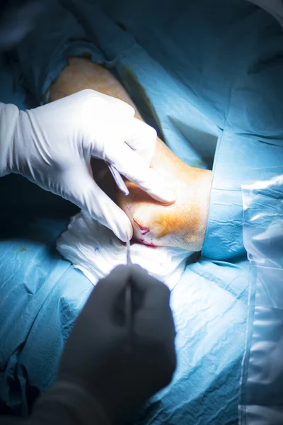 Hôpital chirurgie orthopédique du coude opération — Photo