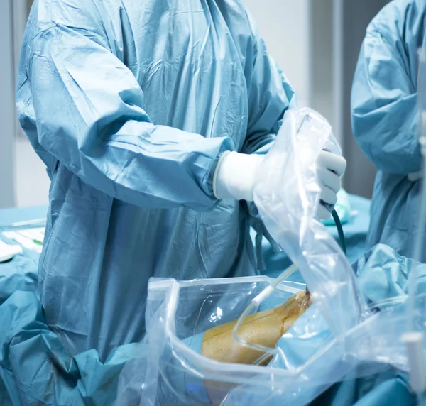 整形外科の膝関節鏡の手術 — ストック写真