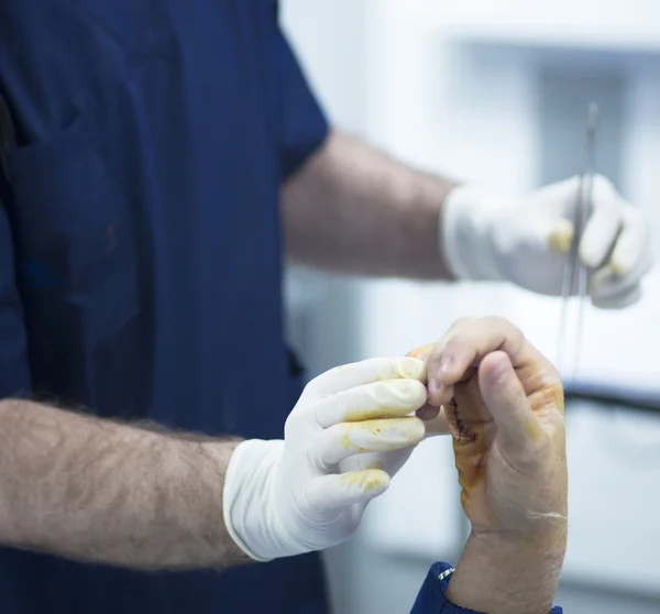 Cirugía de la mano del hospital operación ortopédica —  Fotos de Stock
