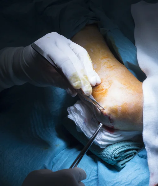 Operasi bedah ortopedi rumah sakit — Stok Foto