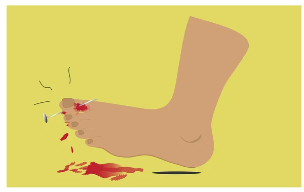 La lesione al piede — Vettoriale Stock