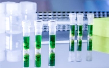 Bilimsel laboratuvarda plastik mikrotüpte yeşil şeffaf sıvı. Bitki örneklerinden DNA çıkarma.