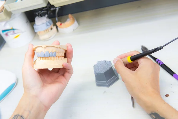 Técnico dental dentista hombre que trabaja con prótesis dentales en un laboratorio con cera en un modelo de mandíbula — Foto de Stock