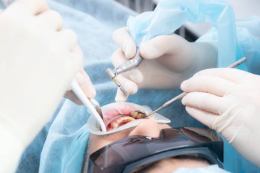 Diş hekimlerinin elleri steril eldivenlerle yakın plan, implantasyon aracı ile..