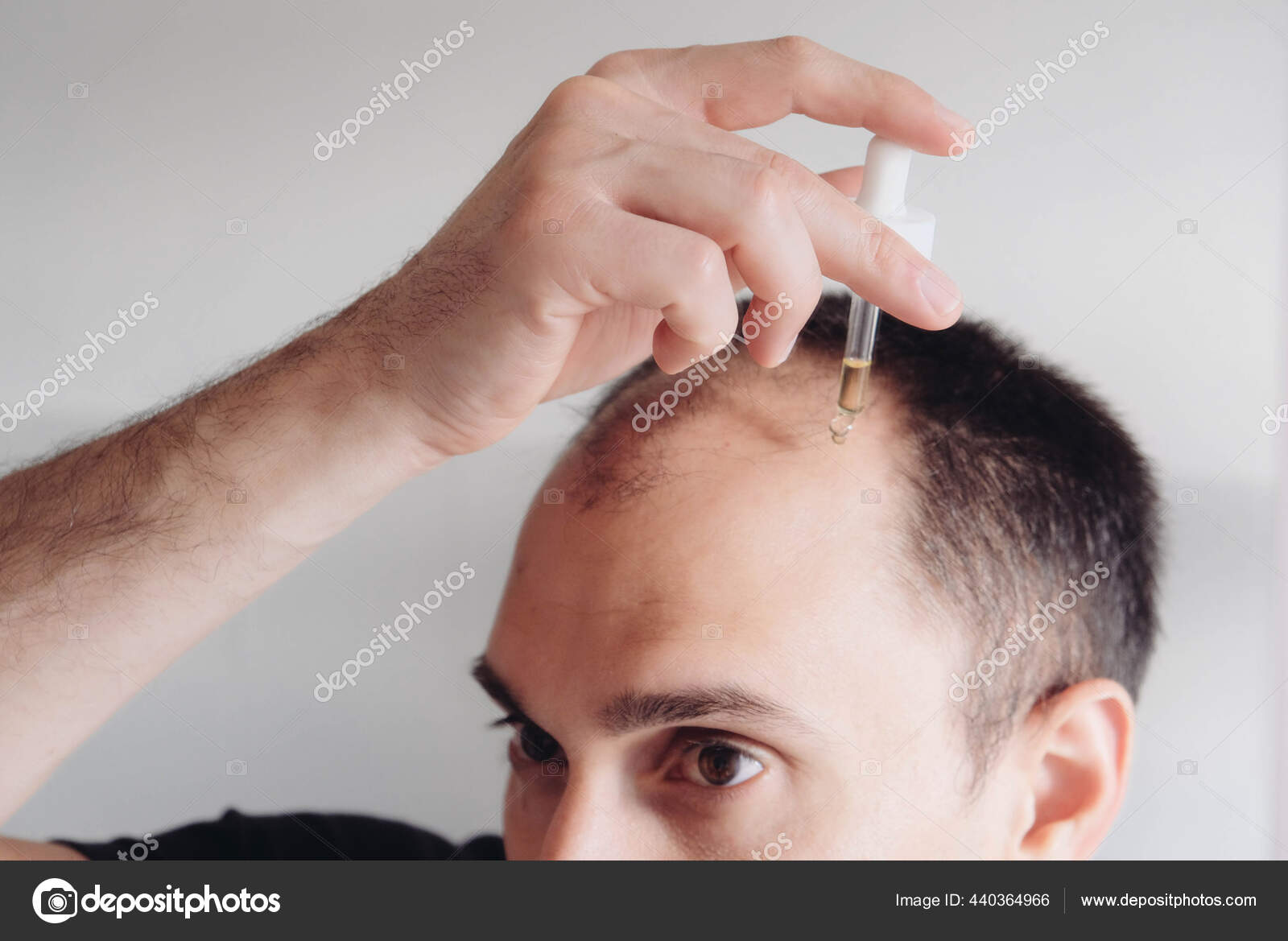 Hair Loss Treatment Men Concept Young Caucasian Man Looking Mirror Stock  Photo by ©PippiLongstocking 440364966