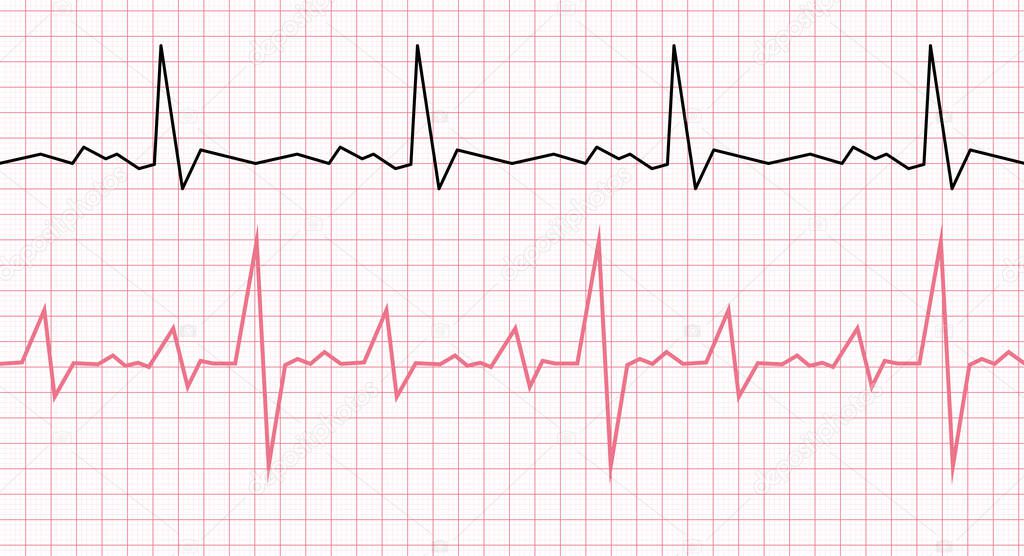 Cardiogram on a graph paper. Heartbeat line. Vector illustration