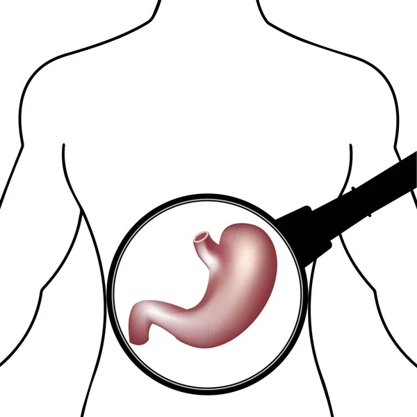 Estómago Aislado Sobre Fondo Blanco — Archivo Imágenes Vectoriales