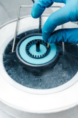 Vitrification  (cryostorage) of sperm samples or oocytes clipart