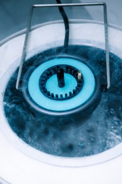 Vitrifiye (cryostorage) yumurta ve sperm örnekleri
