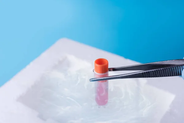 Laboratuvarda numunenin dondurulması. Bilim adamları test tüpünü tutuyor. Sperm ve yumurta içeren sıvı nitrojen bankası. Laboratuvarda Corona virüs testi.