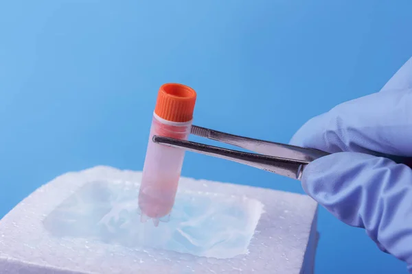 実験室でのサンプルの凍結保存 科学者は試験管を持ってる 精子と卵の結晶を含む液体窒素バンク 研究室でのコロナウイルス検査 — ストック写真