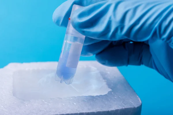 Laboratuvarda numunenin dondurulması. Bilim adamları test tüpünü tutuyor. Sperm ve yumurta içeren sıvı nitrojen bankası. Laboratuvarda Corona virüs testi.