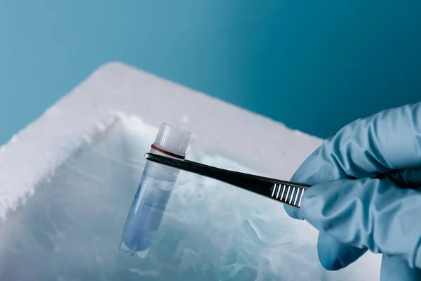 実験室でのサンプルの凍結保存 科学者は試験管を持ってる 精子と卵の結晶を含む液体窒素バンク 研究室でのコロナウイルス検査 ロイヤリティフリーのストック画像