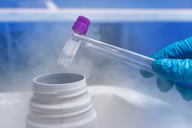 Tüp cryopreserved hücre süspansiyon ile düşük sıcaklık banka üzerinde tutan el