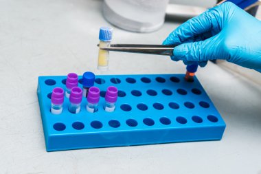Tüp cryopreserved hücre süspansiyon ile düşük sıcaklık banka üzerinde tutan el