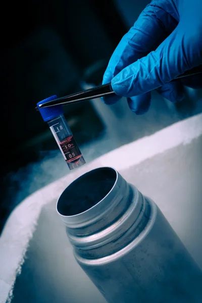 Kök hücre süspansiyon ile sıvı azot bankada çalışan bilim adamı.